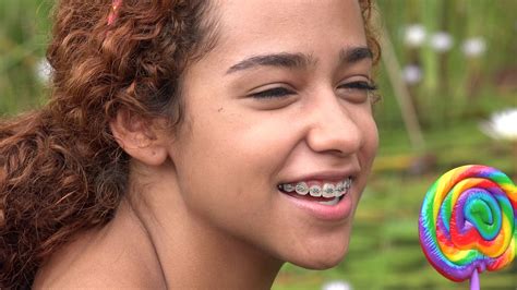 Latina Teen Girl Lollipop Fun Braces - YouTube